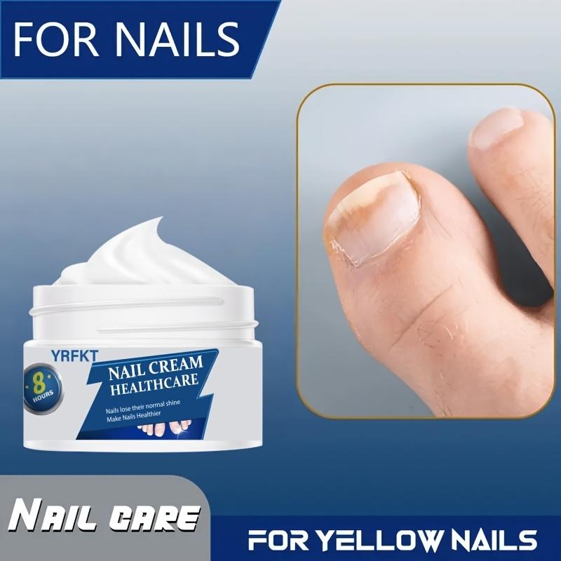 Nail Care Cream, Safe and Gentle for Repairing Nails On Hands, Feet, and Toes, Removing Nail Fungi, Repairing and Caring for Paronychia