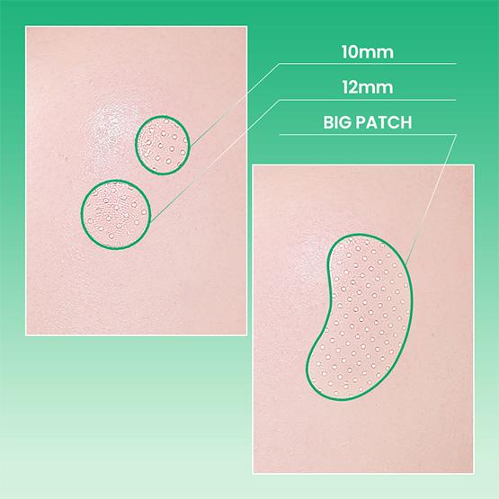 ilso No Problem Spot Patch 72P