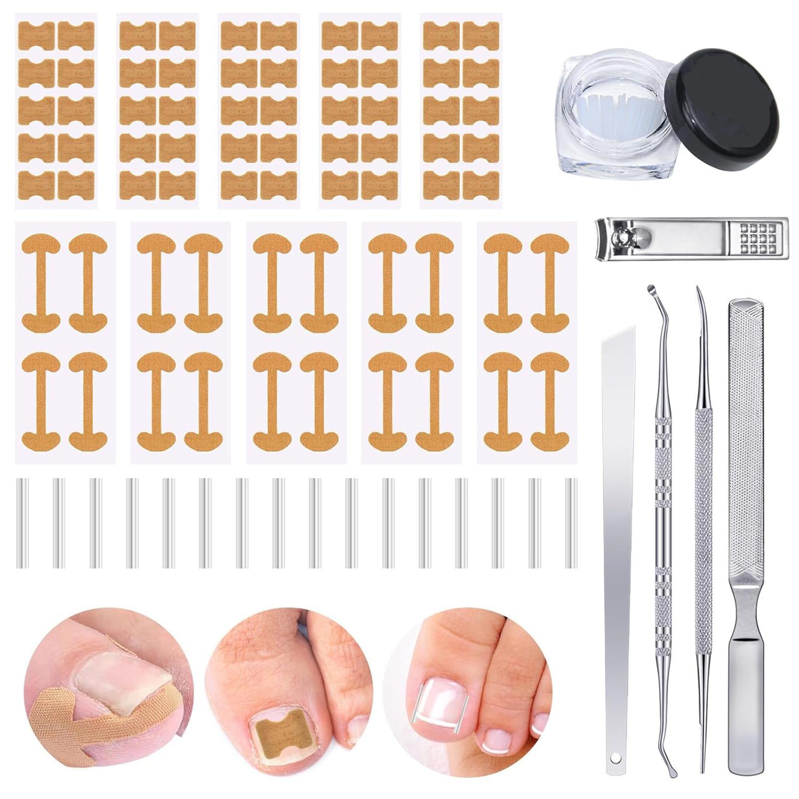 

Professional Toe Nail Correction Kit For Women And Men With Breathable Toe Strips Painless Nail Files Foot Care Tools 16pcs set
