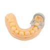 Dental Dam Clips Set 4pcs High Quality Resin Barrier Clamps Rubber Section For Teeth Treatment Room