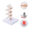 Professional Osteoporosis Model Human Anatomical Spine Model for Teaching Demonstration