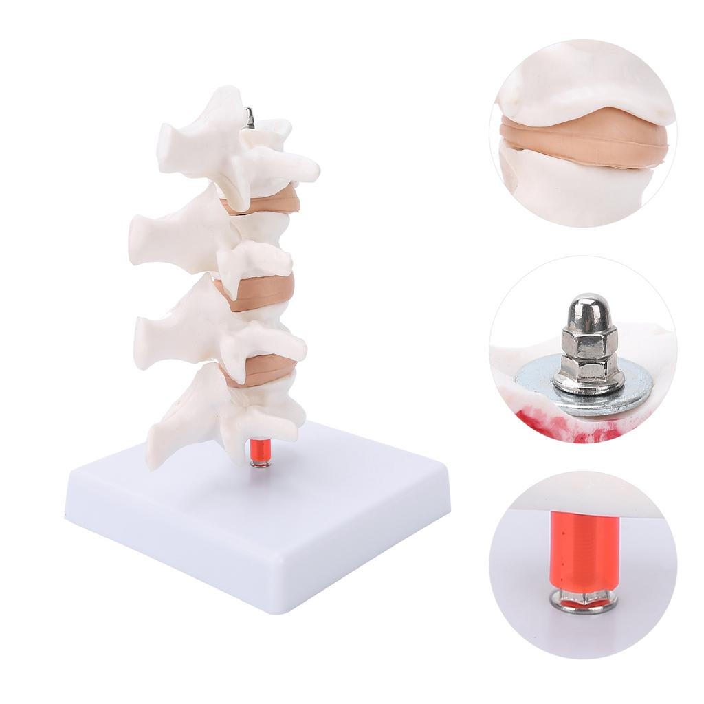 Professional Osteoporosis Model Human Anatomical Spine Model for Teaching Demonstration