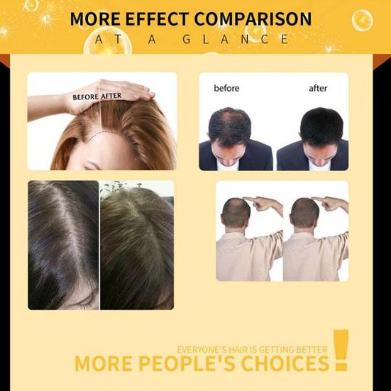 LAVDIK 20ml Hårvekstserum Eterisk Olje Reparer Skadet Nærende Væske