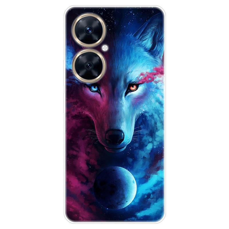 Für Huawei nova 11i nova11i Fall Weiche Silikon Zurück Abdeckung Cartoon Telefon Fall Diversifizierung