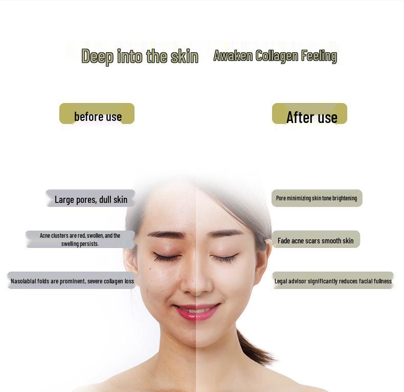 EMS Color Light Photonic Beauty Device for Microcurrent Skin Rejuvenation