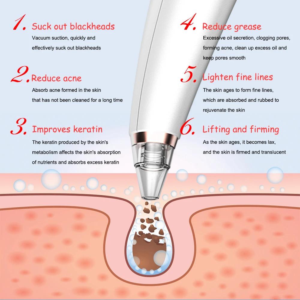 Beauty Instrument 6 Nozzle Facial Vacuum Pore Cleaner. Instrument for cleaning pores and blackheads. Instrument for facial cleansing and exfoliation
