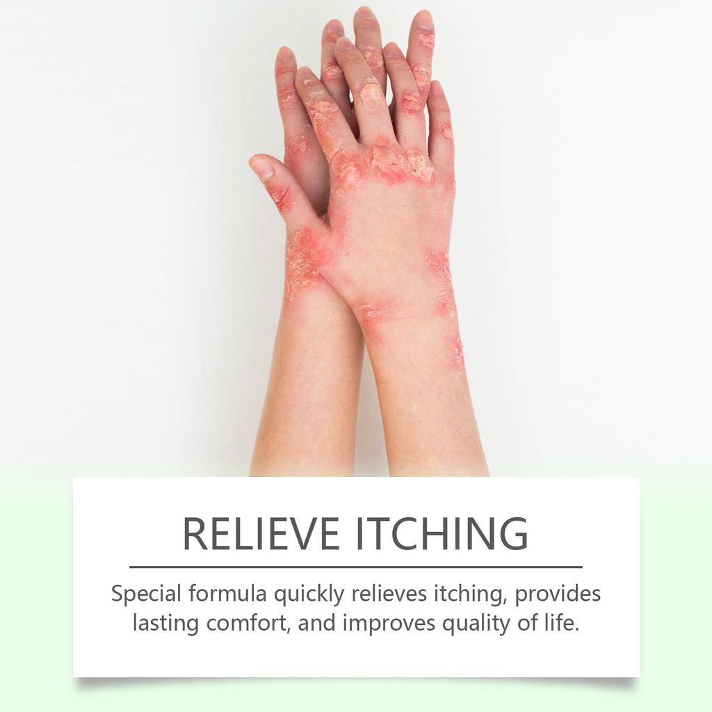 Ximonth Skin Repair Cream Gentle Nourishing Formula For Enhanced Comfort 30g