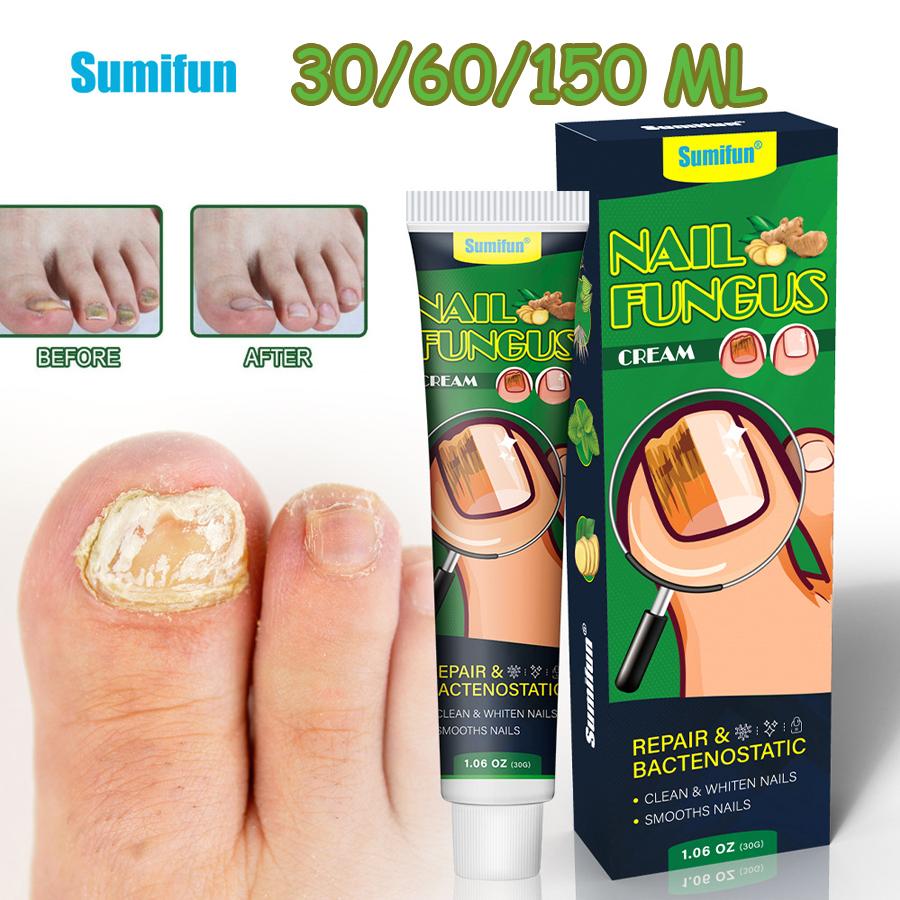 

Sumifun 30/60/150 мл Крем для восстановления серых ногтей Облегчает серый цвет ногтей Утолщает Питает и увлажняет ногти Мазь 1PC