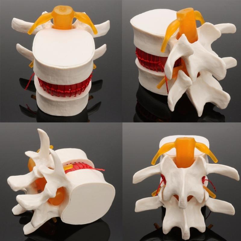 Human Anatomy Skeleton Spine Lumbar Disc Herniation Brain Skull Model Traumatic Pistol Medical Teaching Instrument for School
