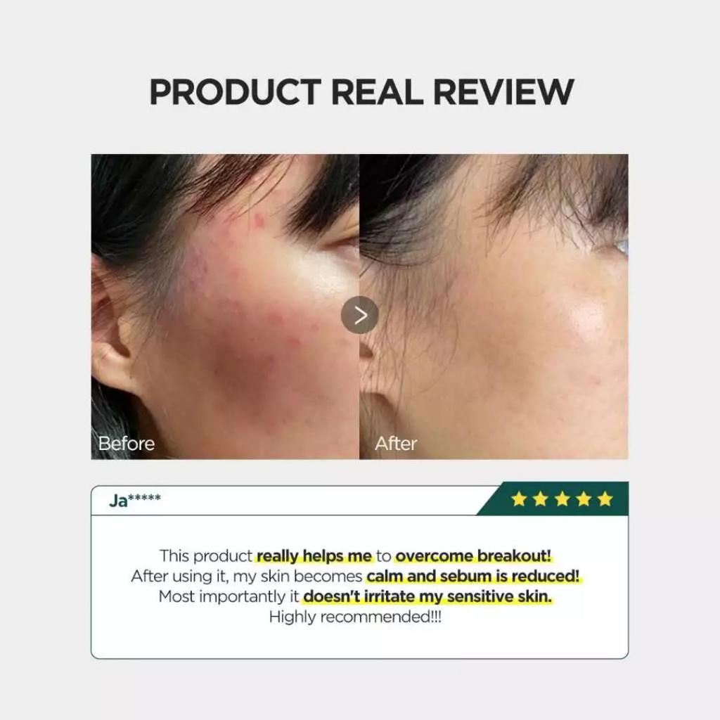 P.CALM Barrier Cycle Daily Mask Pack 30sheet