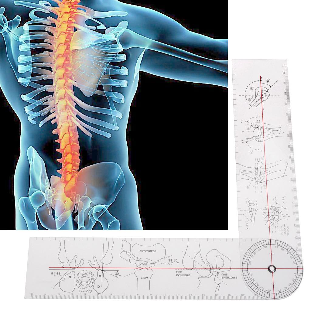 Professional Portable Orthopedic Medical Measuring Angle Ruler Suitable for Family Hospitals Orthopedics