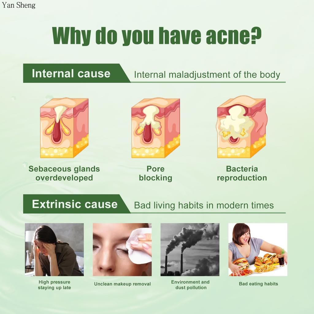 Gesichtsgel Gesichtsreinigung Feuchtigkeitsspendend Reparierend Haut