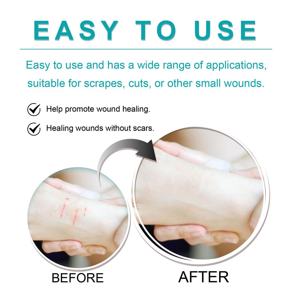 Wound Relief Gel, Liquid Wound Suture Glue, Isolate And Keep Dry 10ml
