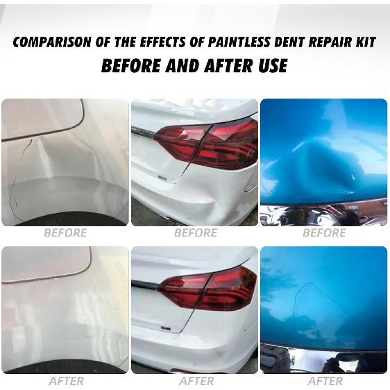 39PCS Auto Dent Puller Kit - Adjustable Golden Dent Remover Tools Paintless Dent Repair Kit Dent Lifter Puller for Car Large & Small Ding Hail Dent