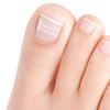 10 Pezzi Strisce Correttive per Unghie Incarnite per Sollevamento Delicato e Allineamento dell'Unghia Strumenti per Pedicure da Salone o per Uso Domestico per Adulti