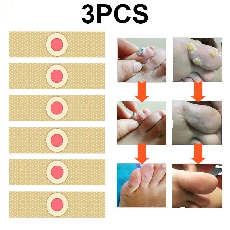 

100 шт. Подушечки для ног для удаления мозолей, немедленные результаты, удобные, прочные материалы, инновационная подушечка для удаления мозолей, паста для удаления мозолей 3PCS