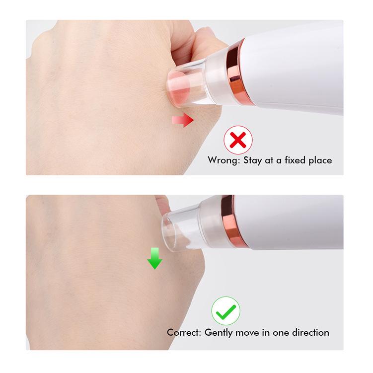 Blackhead Remover & Facial Pore Cleaner for Acne & Mites