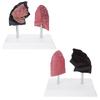 Anatomically Accurate Smoker Lung Comparison Model With Healthy Lung PVC Substance For Clinical Education