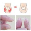 10Pcs Ingrown Toenail Corrector Curved Clip for Paronychia Relief Thick Nails