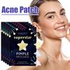 240/280PCS Colourful Star Acne Patches Facial Concealer Facial Acne Patches Concealer Acne Patches Ultra-thin