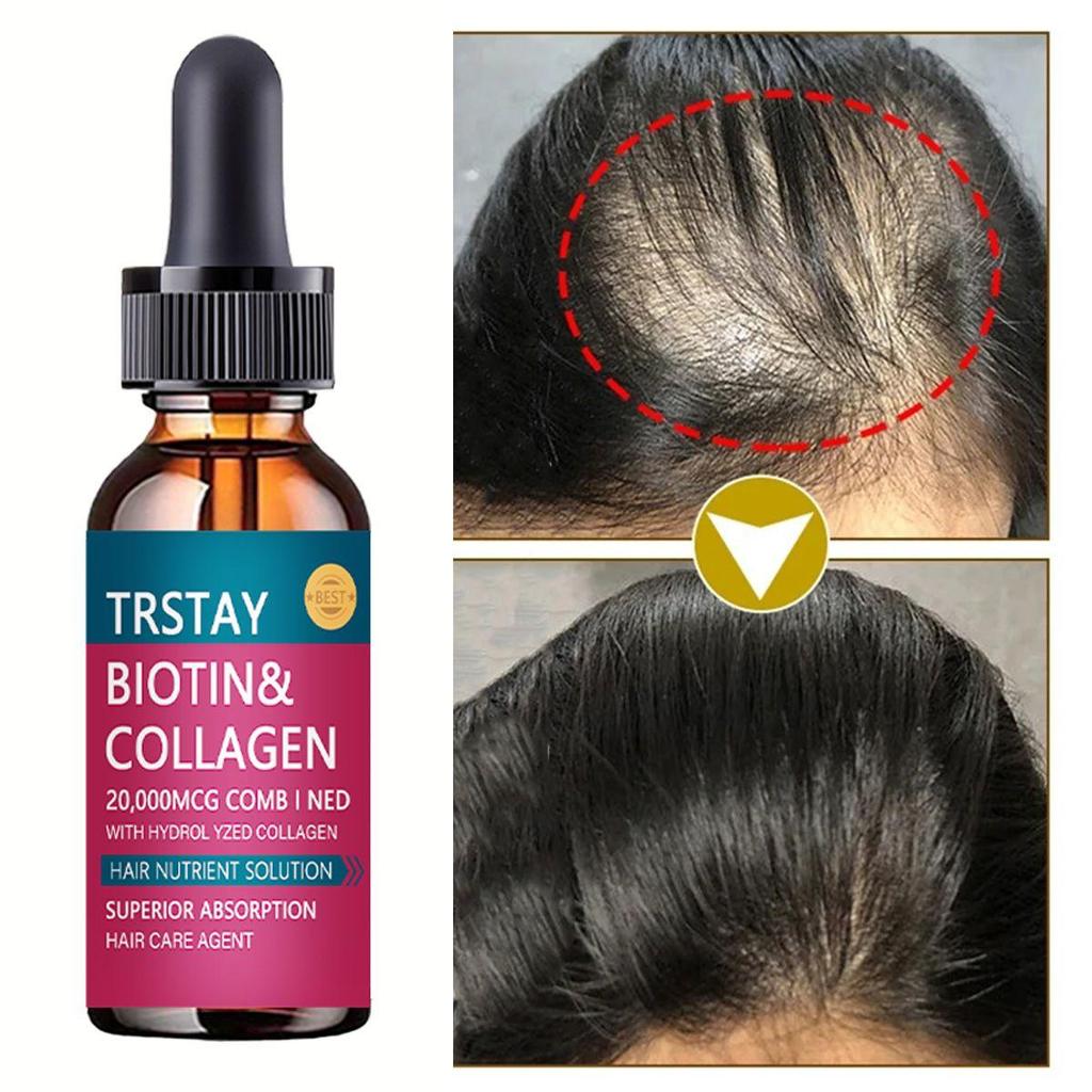 5 ML/15 ML/30 ML/50 ML/nye ingefær hårvekstprodukter Hurtigvoksende hår essensiell olje forhindrer hårtap Olje hodebunnsbehandling for menn kvinner