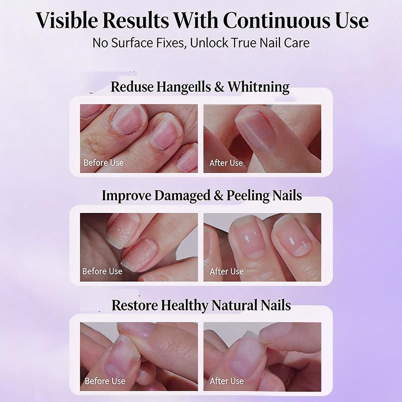 Anti-Barb Nail Cuticle Oil Moisturizing Nourishing Nail Cuticle Remover Pen Brighten Nail Care Pen