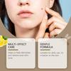 Verruca Care Cream Gentle Cleansing, Moisturizing And Softening The Skin, Reducing Skin Discomfort.