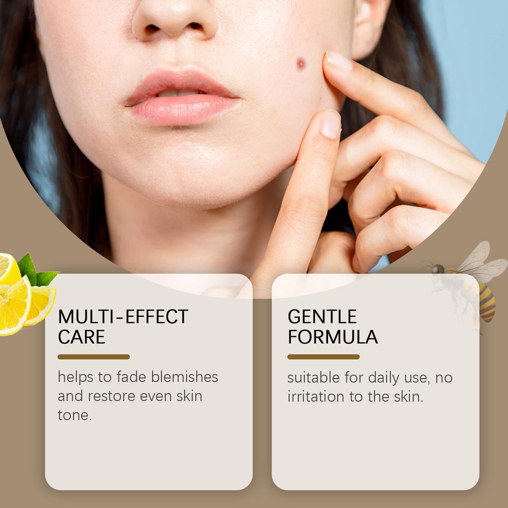 Verruca Care Cream Gentle Cleansing, Moisturizing And Softening The Skin, Reducing Skin Discomfort.