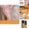Premium Varicose Vein Repair Cream Relieves Soreness Swelling And Bulging Veins