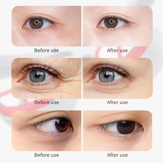 Red Light Therapy Glasses Under-Eye Massager Portable Eye Care Device LED Eye Perfector for Wrinkle Removal Skin Firming