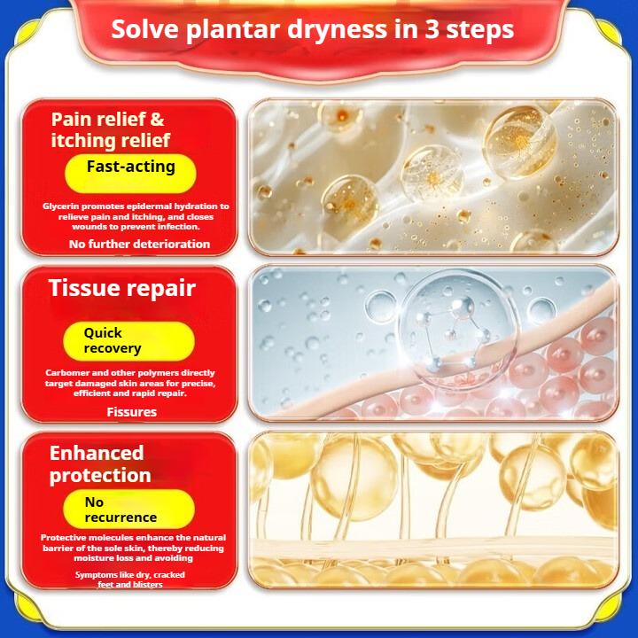 Kräm för spruckna fötter, kräm för spruckna hälar, spruckna händer och fötter, svampinfektion, salva för fjällning och sprickbildning [Köp mer för fler rabatter]