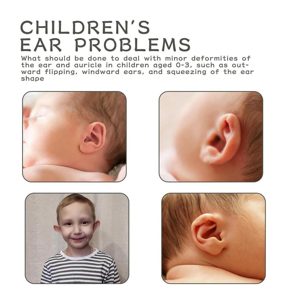 WIIEEY Silicone Auricular Correction Stickers Help Children Correct Dilated Ears Breathable and Waterproof Stickers