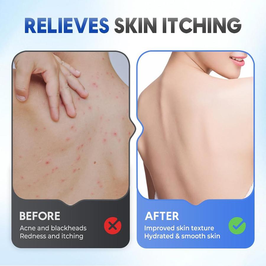 Shower Foot Scrubber Mat with Non-Slip Suction Cups,  Foot Scrubber Mats Silicone Shower Wall Mounted Back Scrubbers Massage Pad