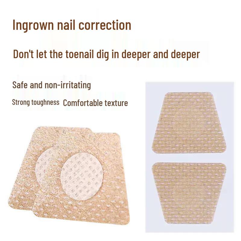 Ingrown Toenail Care Patch: Orthopedic Pad for Soft Nail and Nail Groove Repair