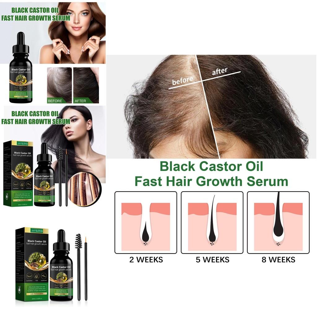 Jaysuing Castor Oil Hair Growth Essence Nourishing Thickening Strengthening Formula