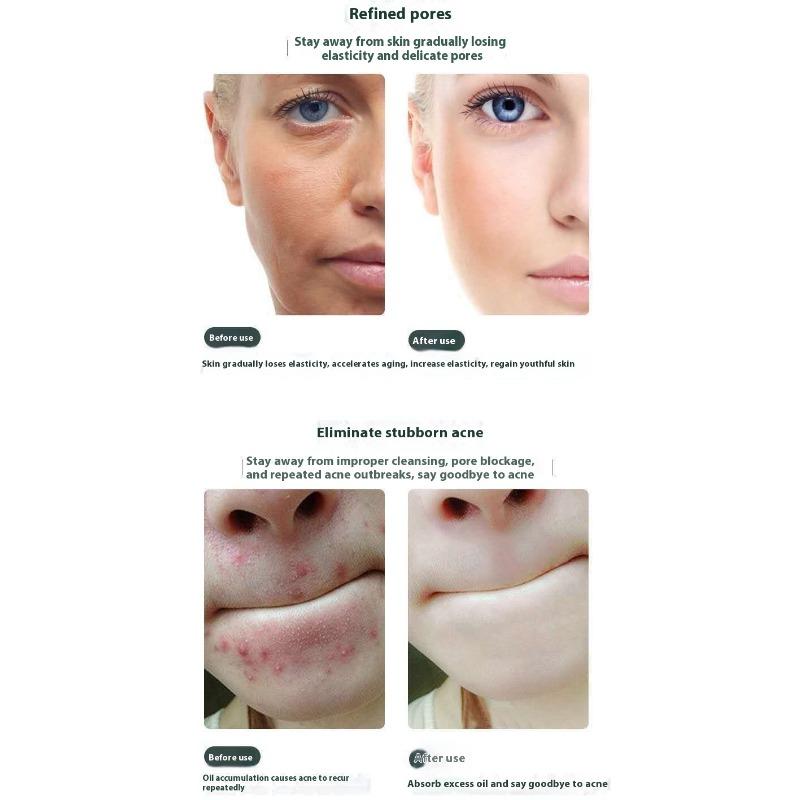 Ice Crystal Cleansing Gel Cleansing Cream for Face Blackening Discharge Black Toxins Blackhead Acne Shrinking Pores for Beauty