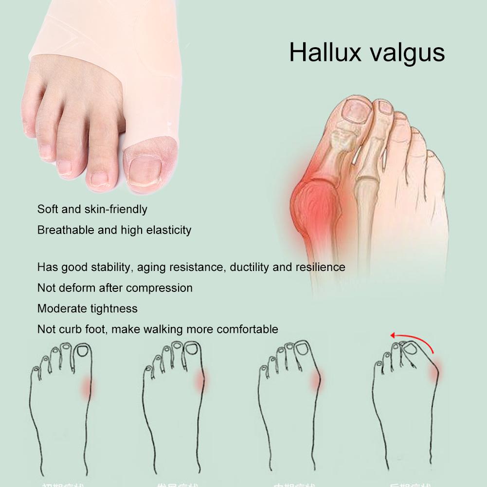 2 Pairs Hallux Valgus Bunion Corrector Elastic Breathable Toe Separator Correction ToolSkin Color