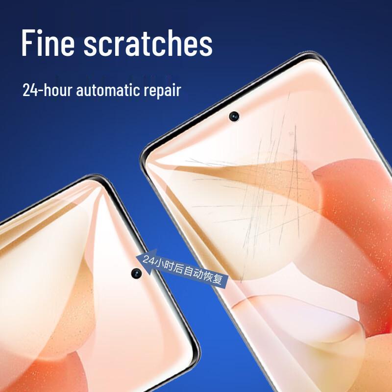 Smorss Screen & Lens Protectors for Xiaomi & Redmi Phones