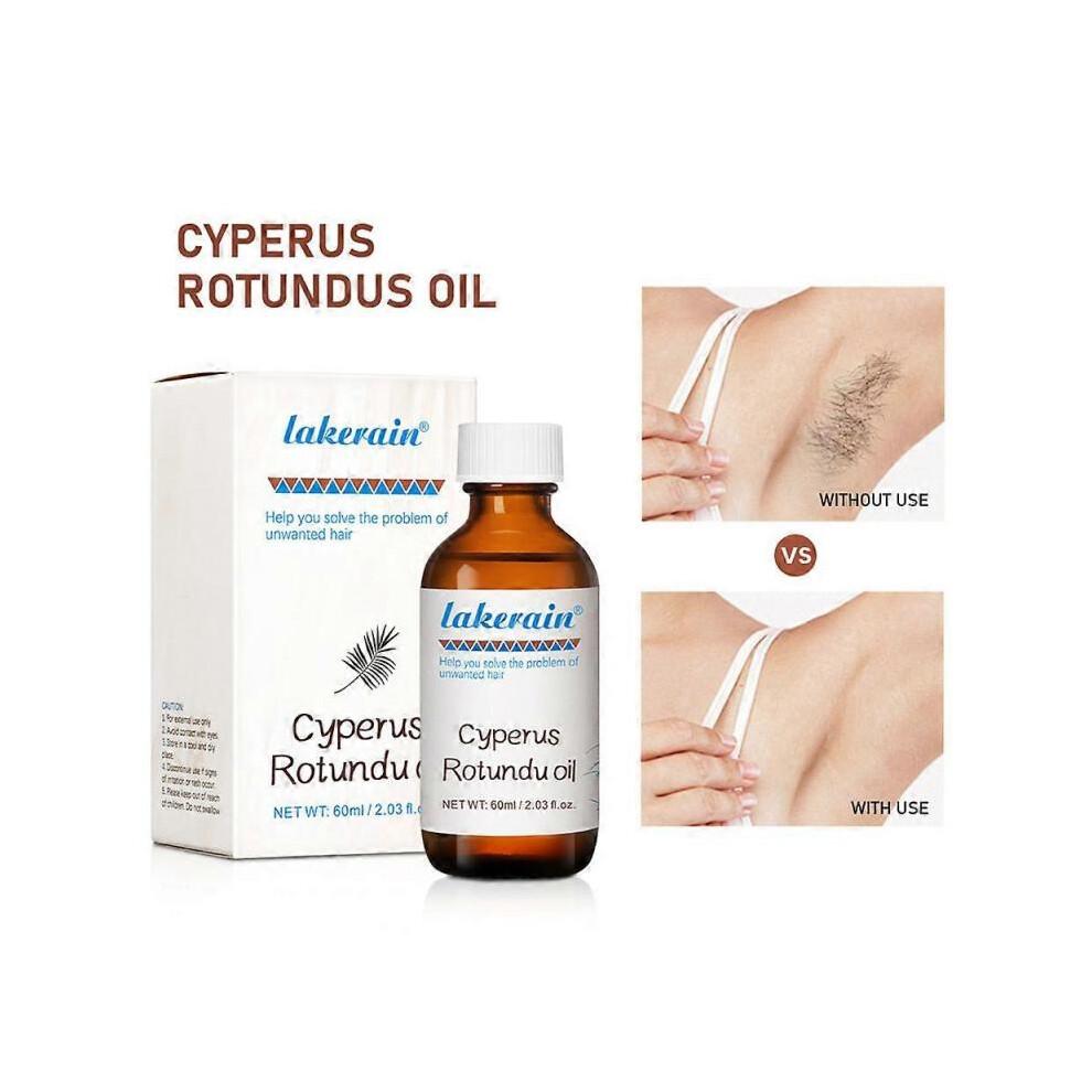 Óleo 100% Puro de Cyperus Rotundus para Remoção de Pelos 60ml