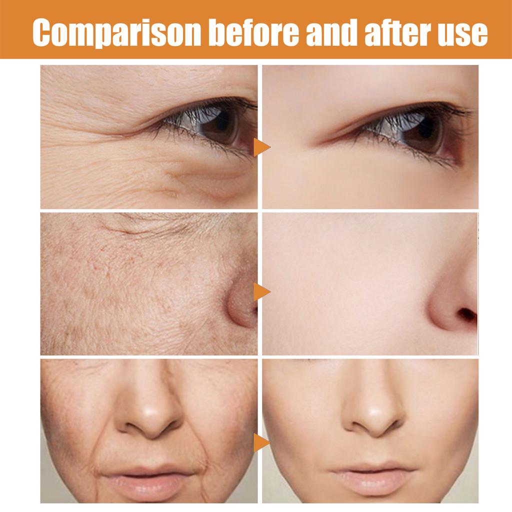 Eelhoe Vitamin C Collagen Facial Serum For Hydration And Moisture 50ml Nourishing Formula