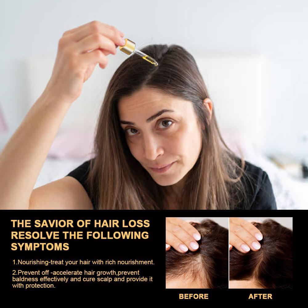 30ml Hair Repair Essence, Anti-hair Loss Nourishing Liquid, Long Hair Nourishing Hairline, Multiflorum Multiflorum Hair Nourishing Essence