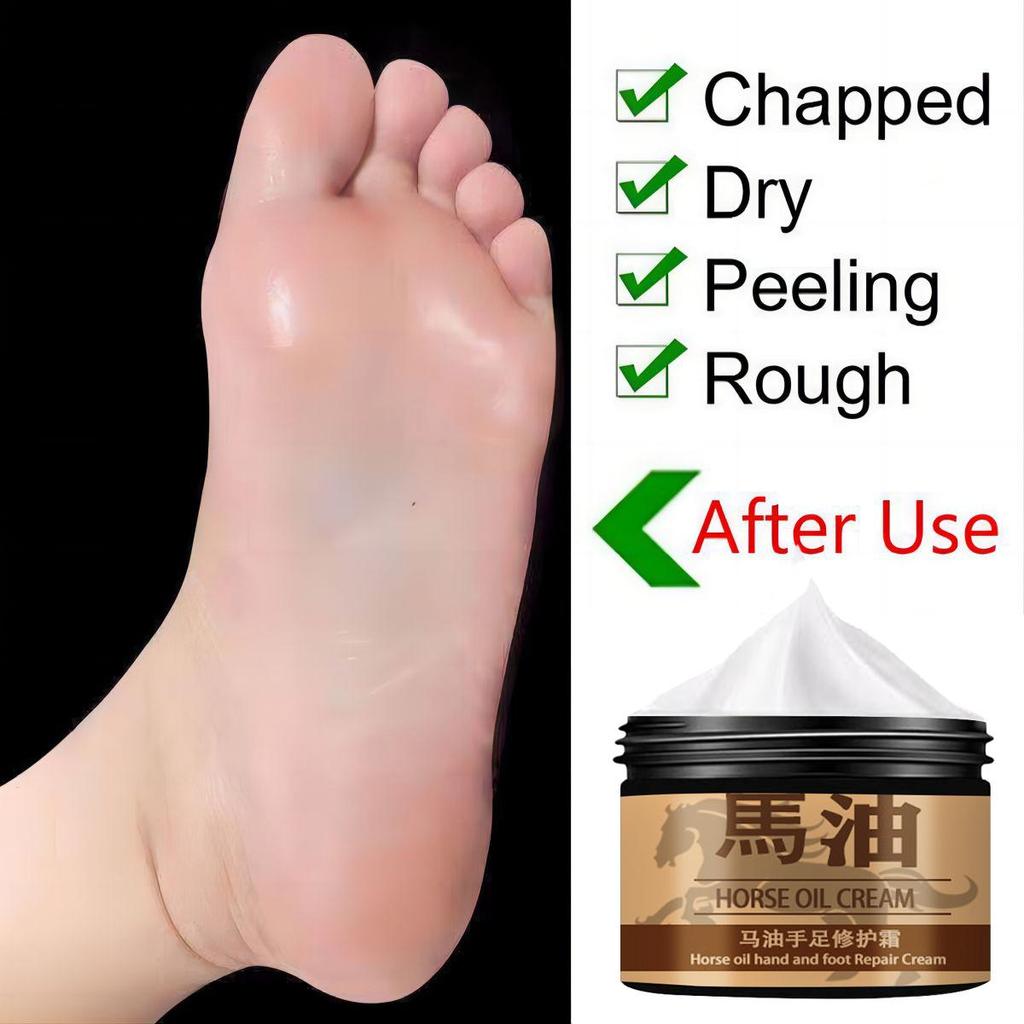 Ma You Hand and Foot Repair Cream doplňuje vlhkost, opravuje poškozenou pokožku nohou, obnovuje zdravou pokožku nohou a hydratuje a chrání nohy.