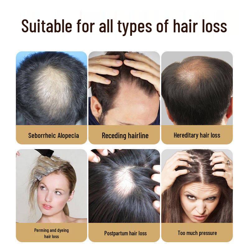 Herbal Hair Growth & Thickening Lotion: Anti-Hair Loss, Follicle Repair, Accelerated Hairline & Hair Density Enhancement.