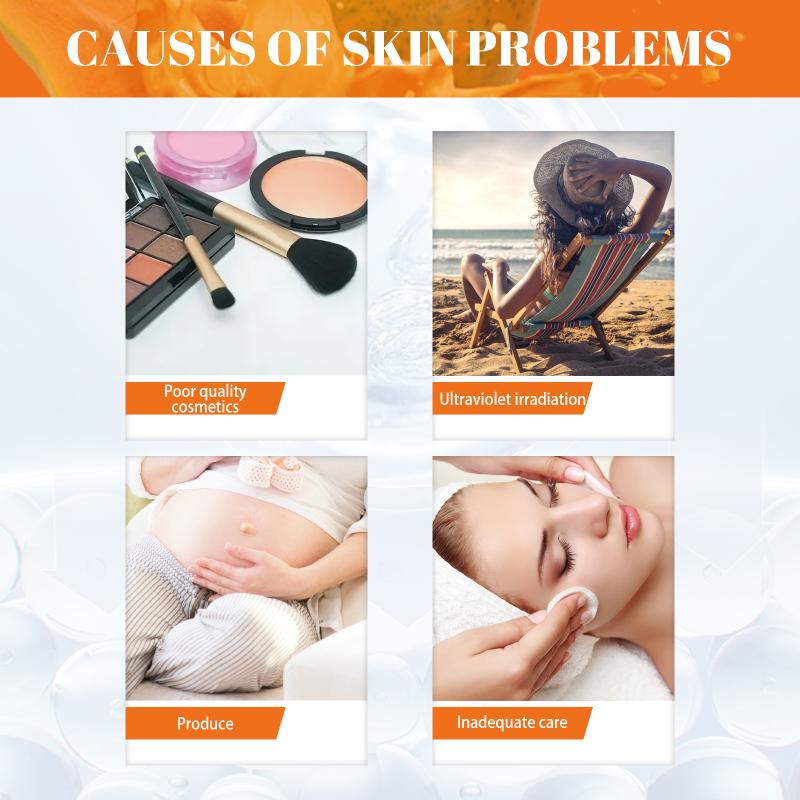 Papaya Freckle Cream Pigmentation Control for Face Moisturizing Brightening Day Cream for Dark Age Spots