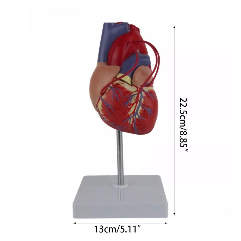 Modello Anatomico di Cuore Umano per Studio Cardiologico che Dimostra il Bypass Cardiaco