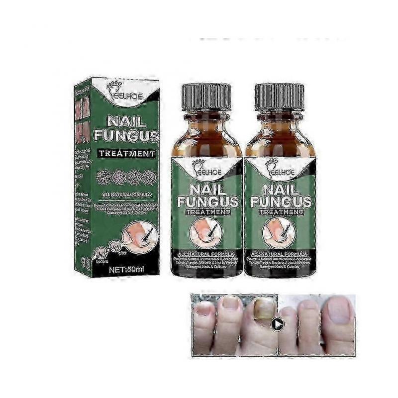 (2pcs)EELHOE Nail Repair Liquid Gray Nail Liquid Uneven Thick Nail Thickening Gray Nail Soft Nail Hand and Foot Repair Liquid