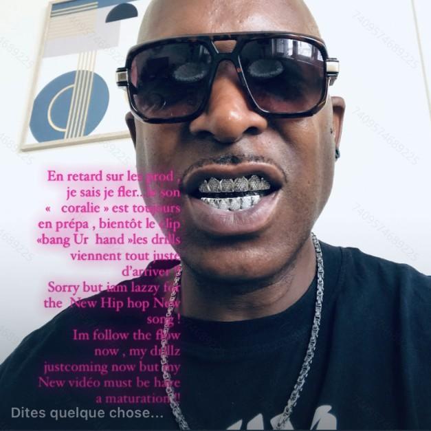 Hot-selling 18K Gold-plated Tungsten Hip-hop Grillz Cross-border Trade Europe America Unisex Antique-style Rhombus-shaped Zircon