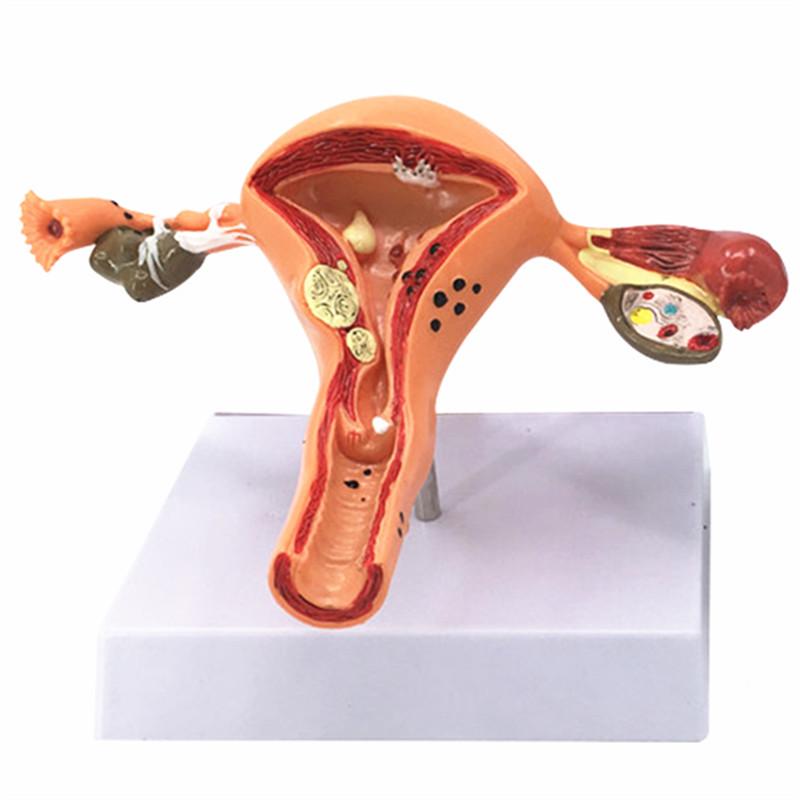Large Female Reproductive Anatomy Model for Teaching and Family Planning