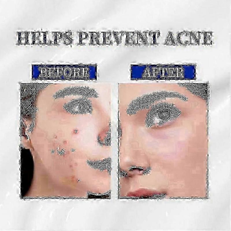3 STÜCK A-313 Vitamin A Retinol Creme A~313 Retinol Anti-Aging Creme für das Gesicht, reduziert Poren & Falten, behandelt Akne & dunkle Flecken