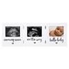 Triple Sonogram Keepsake Baby Picture Frame White Hinged Display Ultrasound Pregnancy Journey Ideal Gift Expecting Parents 3